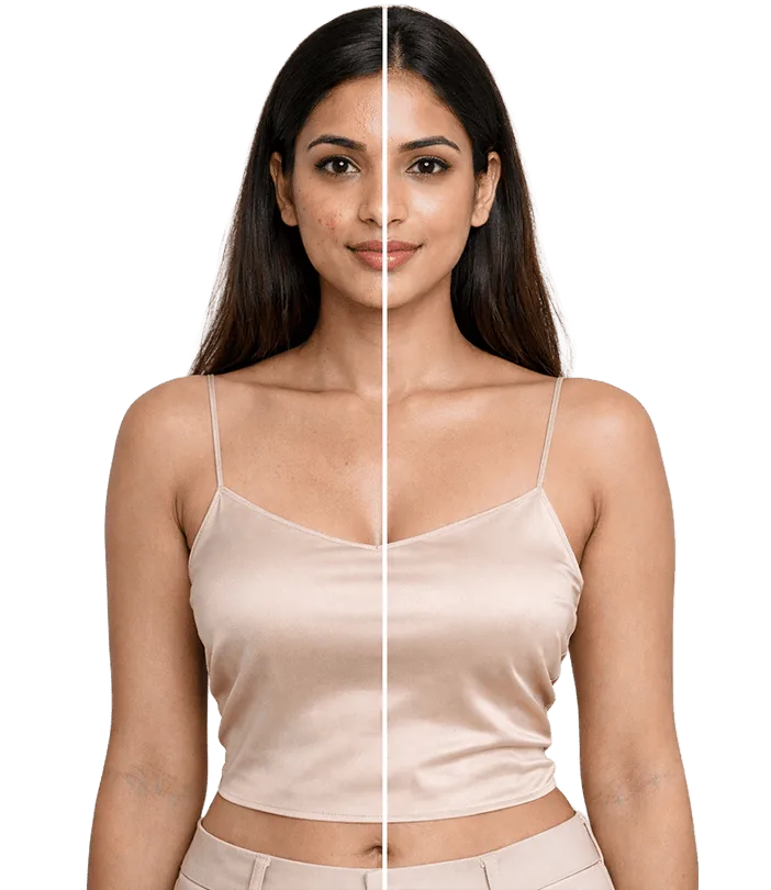 Faceprp Treatment In Chennai Banner
