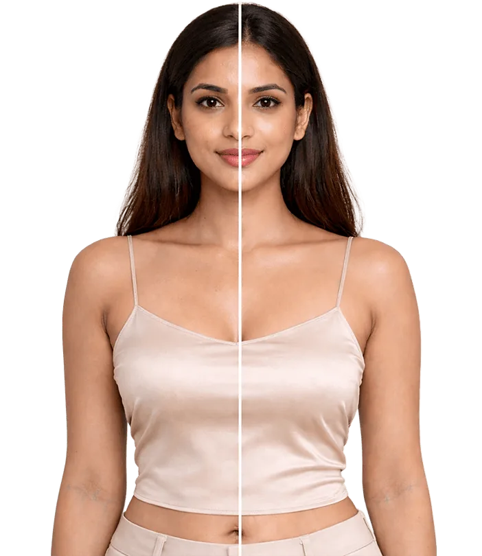 Faceprp Treatment In Chennai Banner3