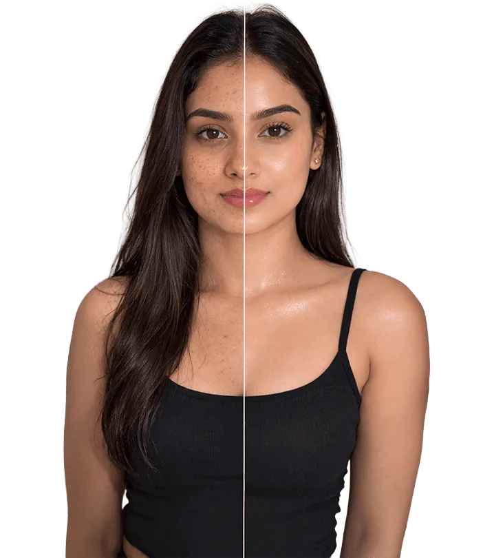 Koreanskin Treatment In Chennai Banner1