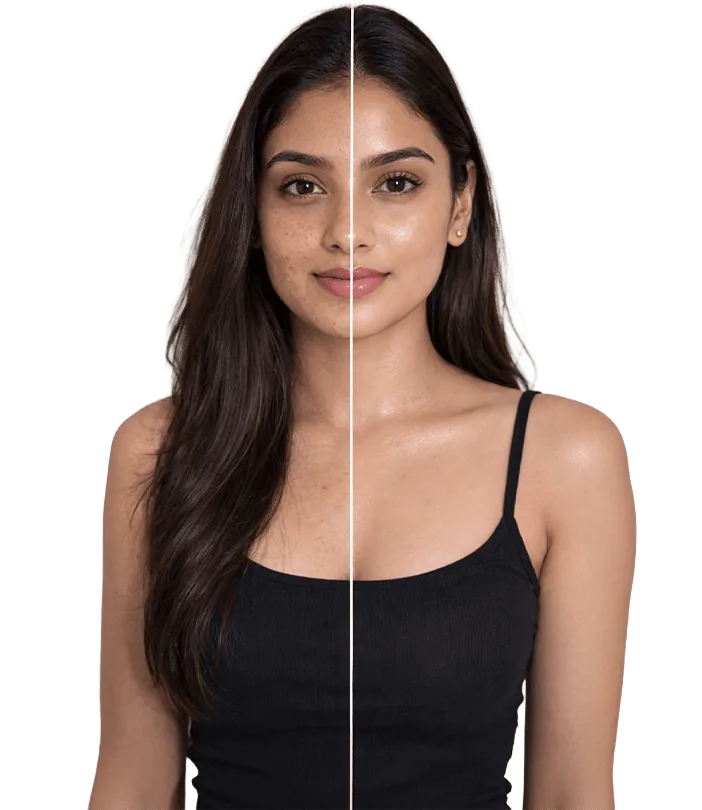 Koreanskin Treatment In Chennai Banner