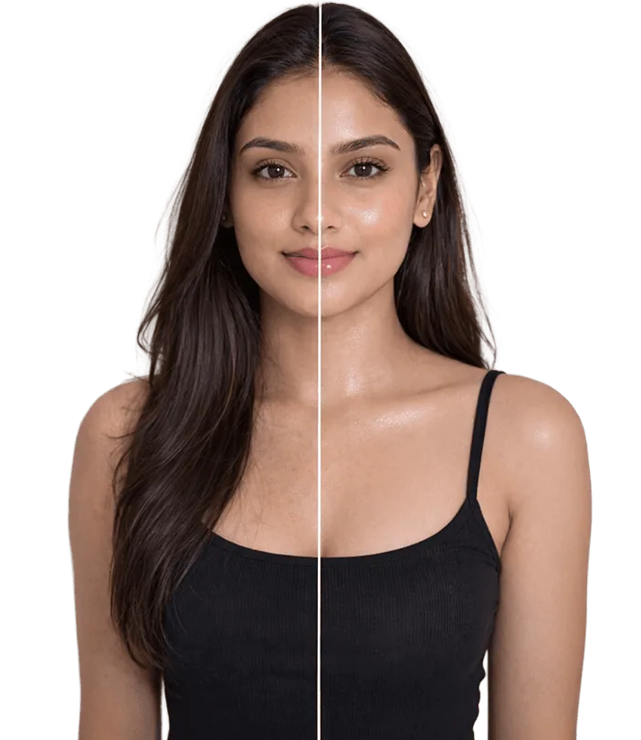 Koreanskin Treatment In Chennai Banner3
