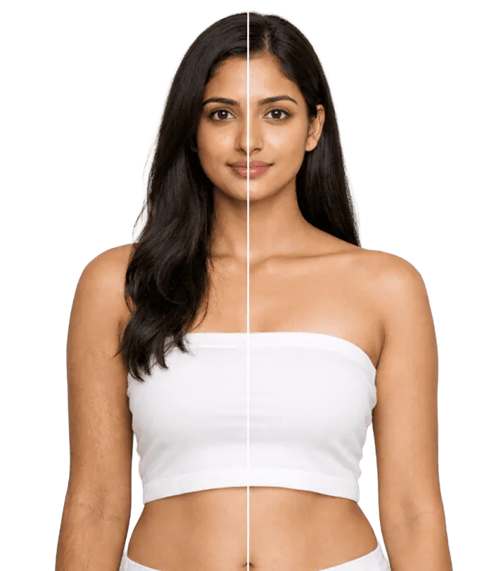 Laserhair Removal Treatment In Chennai Banner1