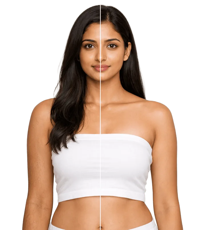 Laserhair Removal Treatment In Chennai Banner