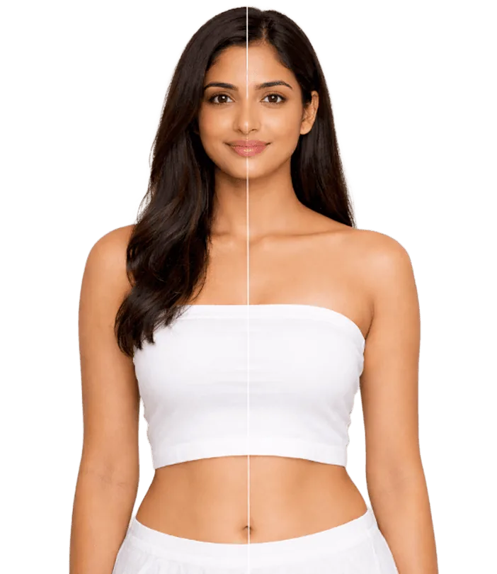 Laserhair Removal Treatment In Chennai Banner3