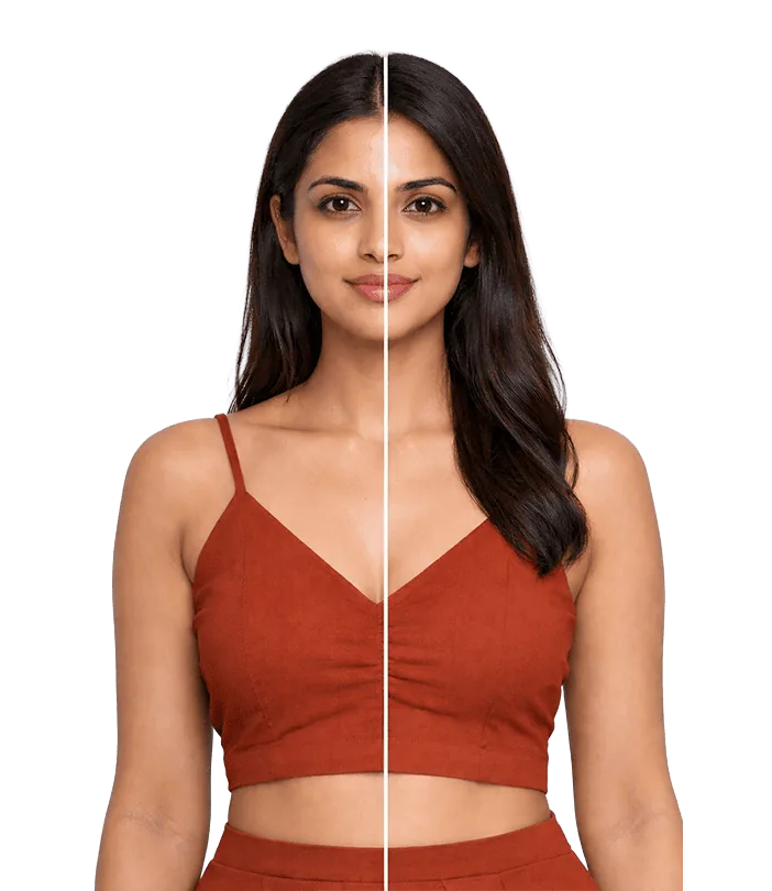 Rf Micro Needling Treatment In Chennai Banner3