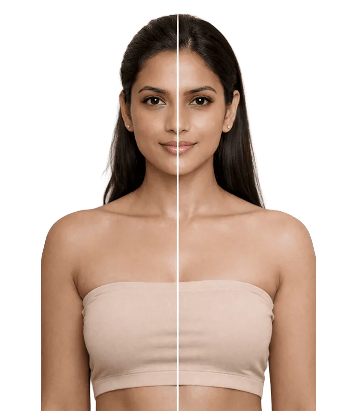 Skin Resurfacing Treatment In Chennai Banner3
