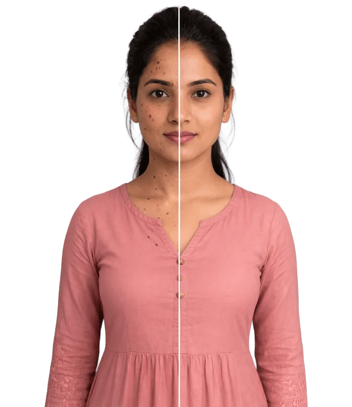 Skin Tag&wart Treatment In Chennai Banner1