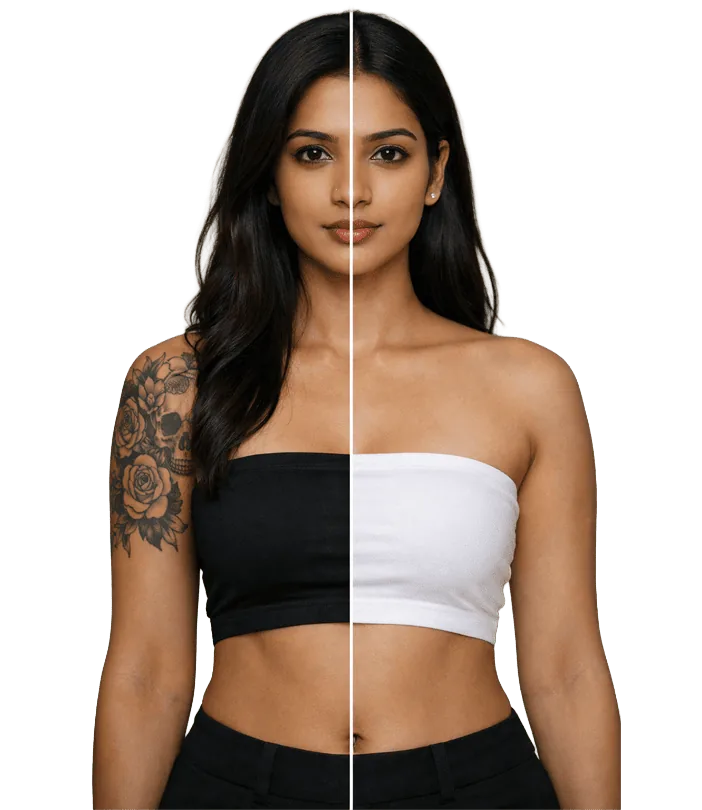 Tattooremoval Treatment In Chennai Banner1