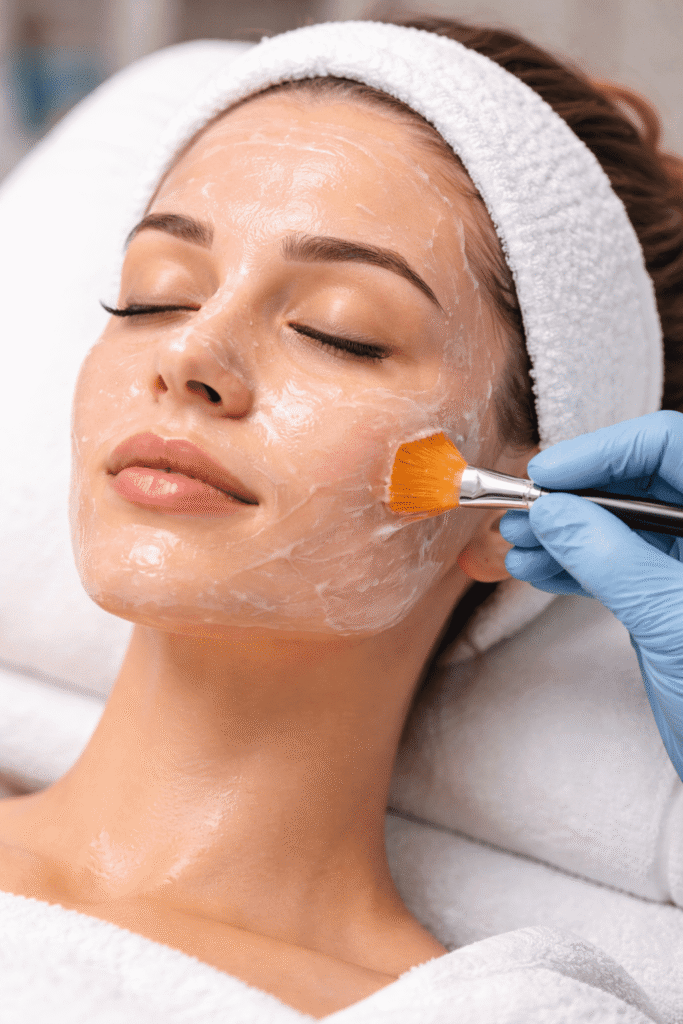 Chemical Peels