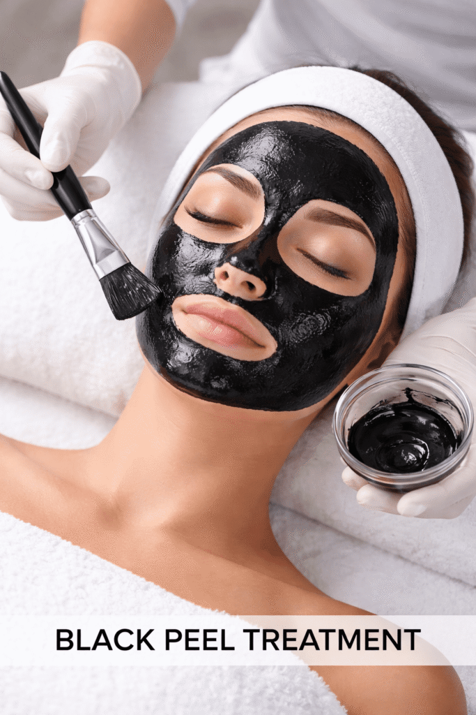 Black Peel Treatment