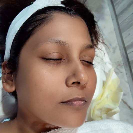 After Face Whitening