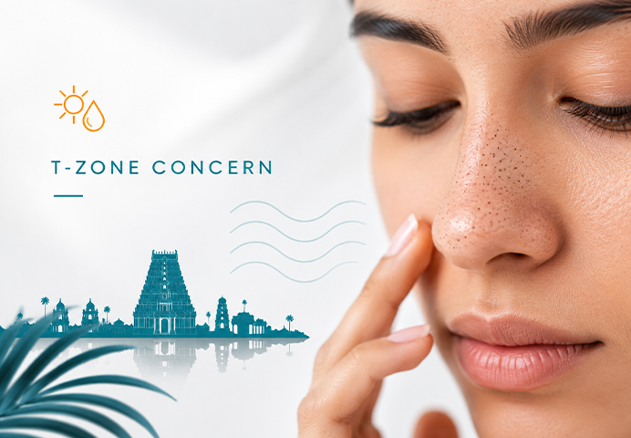 Close-up of tiny black dots and blackheads on nose and T-zone — common skin concern in Chennai's humid climate