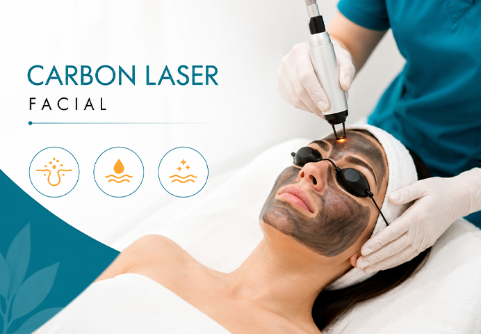 Carbon laser facial treatment being performed at VK Allure Dermaclinic Chennai for blackhead and oily skin management