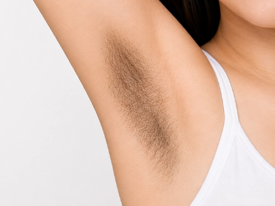 Before laser hair removal underarms